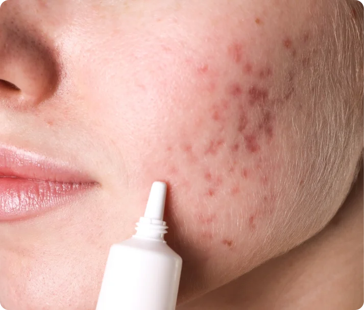 Rélavie skincare